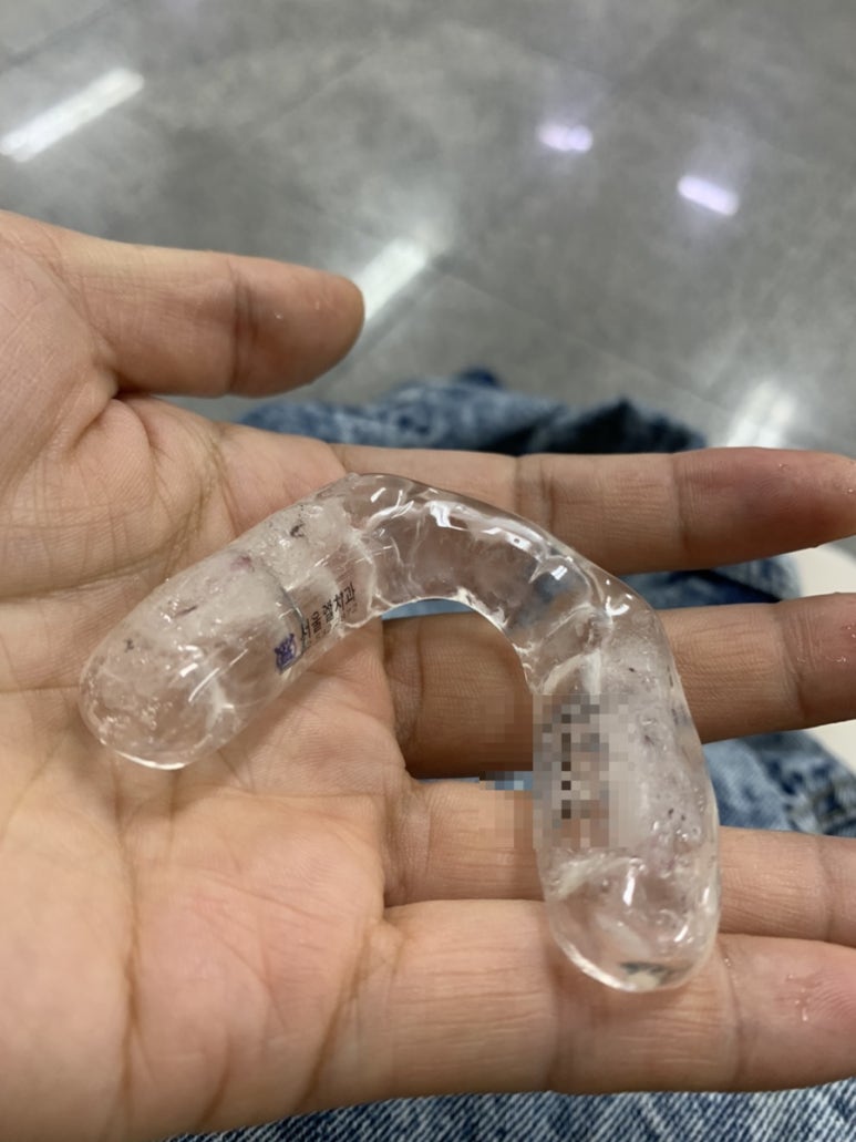 서울엘치과 이미지