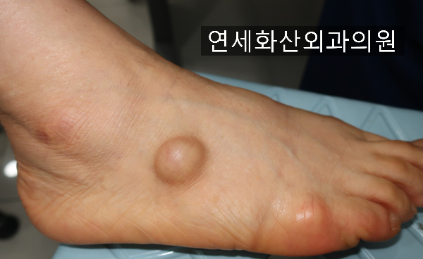 연세화산외과 이미지