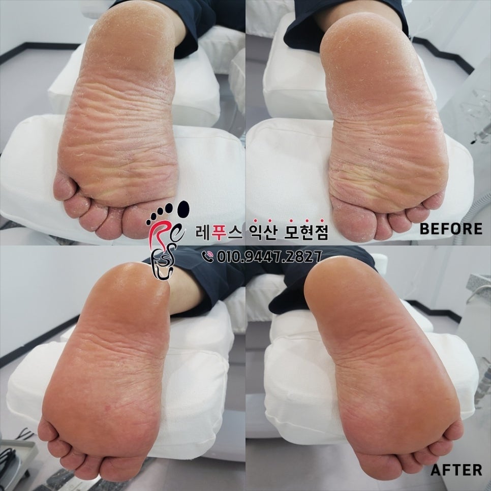 레푸스익산 이미지
