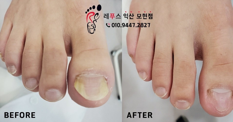 레푸스익산 이미지