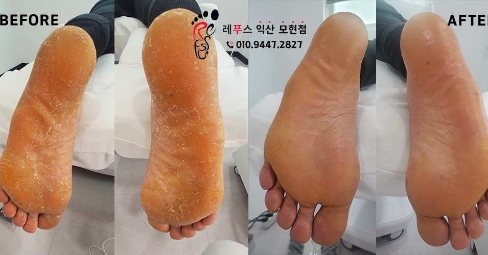 레푸스익산 이미지
