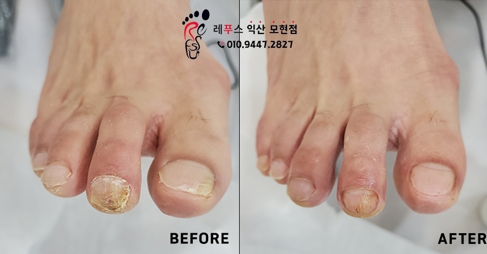 레푸스익산 이미지