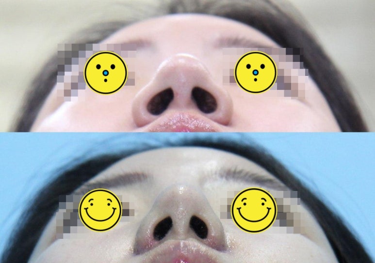 아티스성형외과 이미지