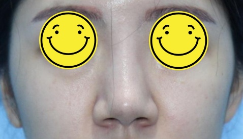 아티스성형외과 이미지