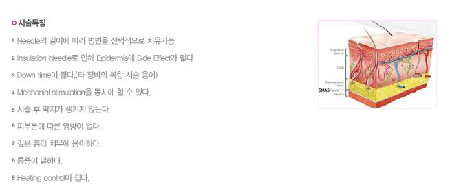 아인셀 이미지