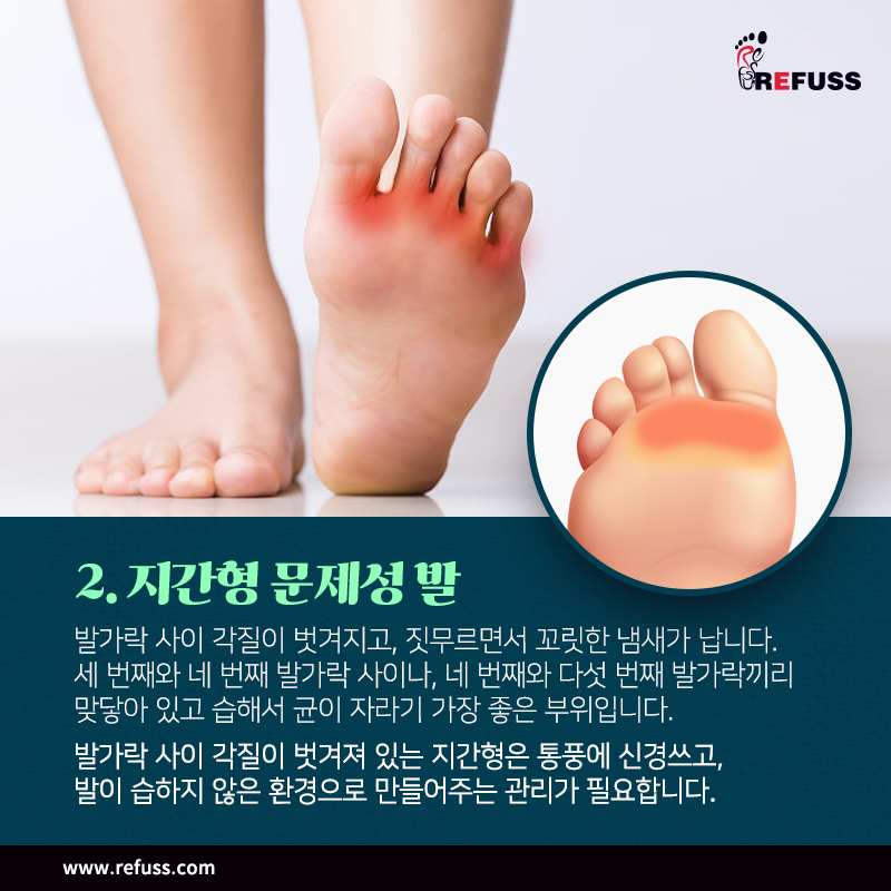 레푸스익산 이미지