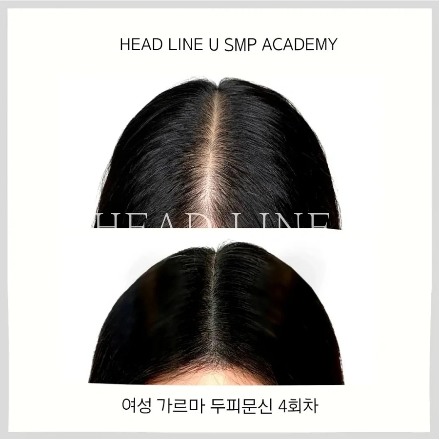 헤드라인유 이미지