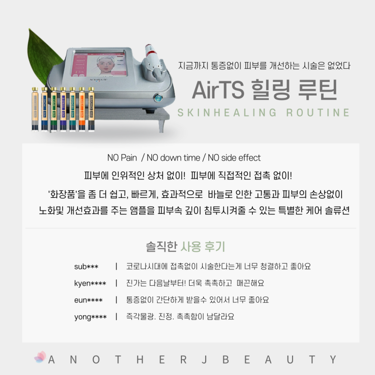 민티에스 이미지