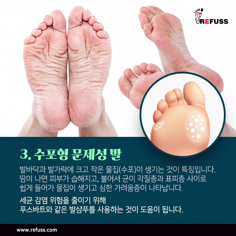 레푸스익산 이미지