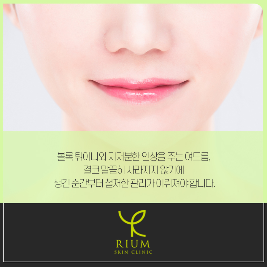 리움피부과 이미지