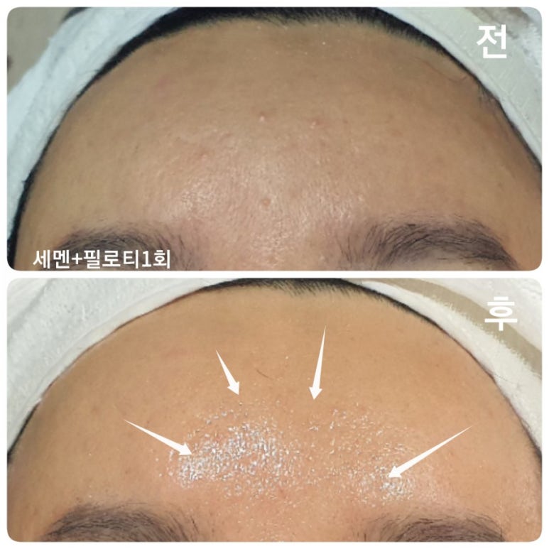 피부빛나다 이미지
