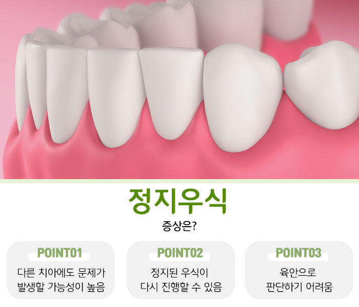 재광정밀 이미지