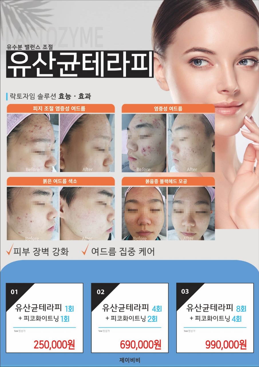 제이비비 이미지