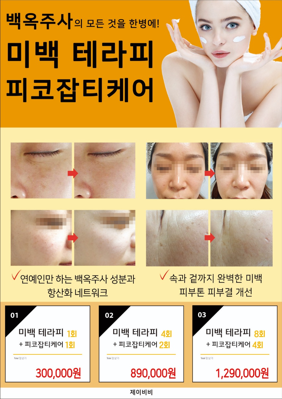 제이비비 이미지