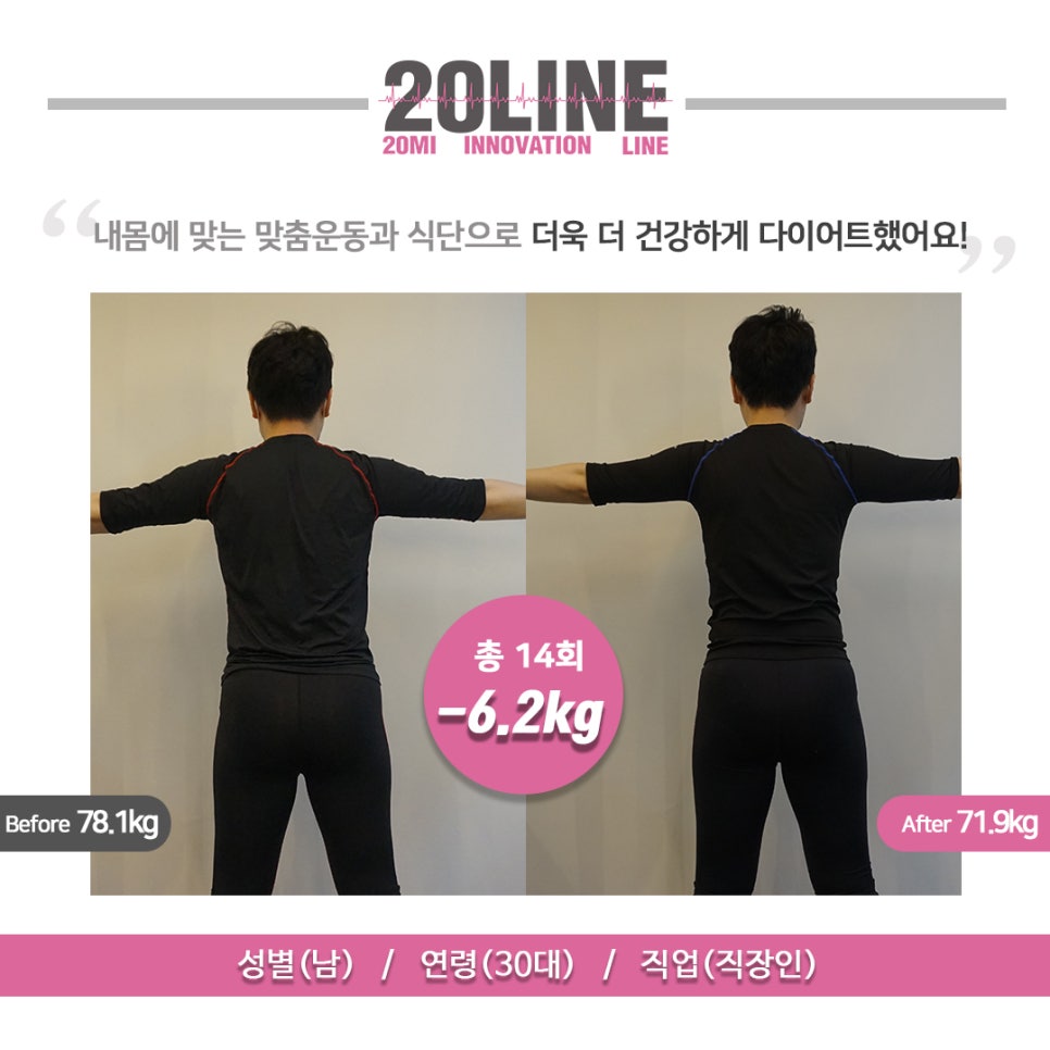 Q체형관리 이미지