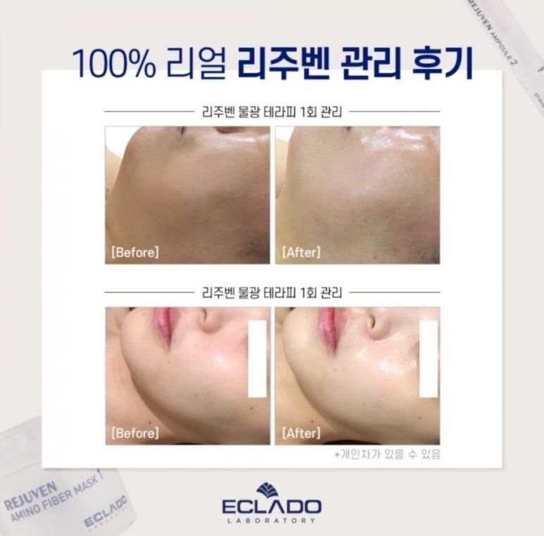 더(The)진 이미지