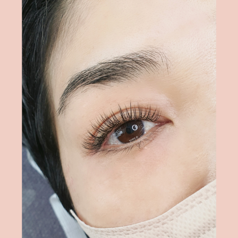 요니뷰티 이미지