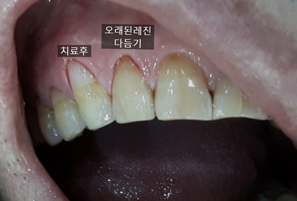 서울호수치과 이미지