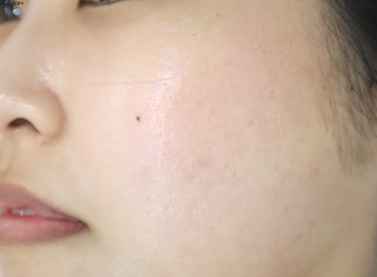 뷰티 썸 스킨 이미지