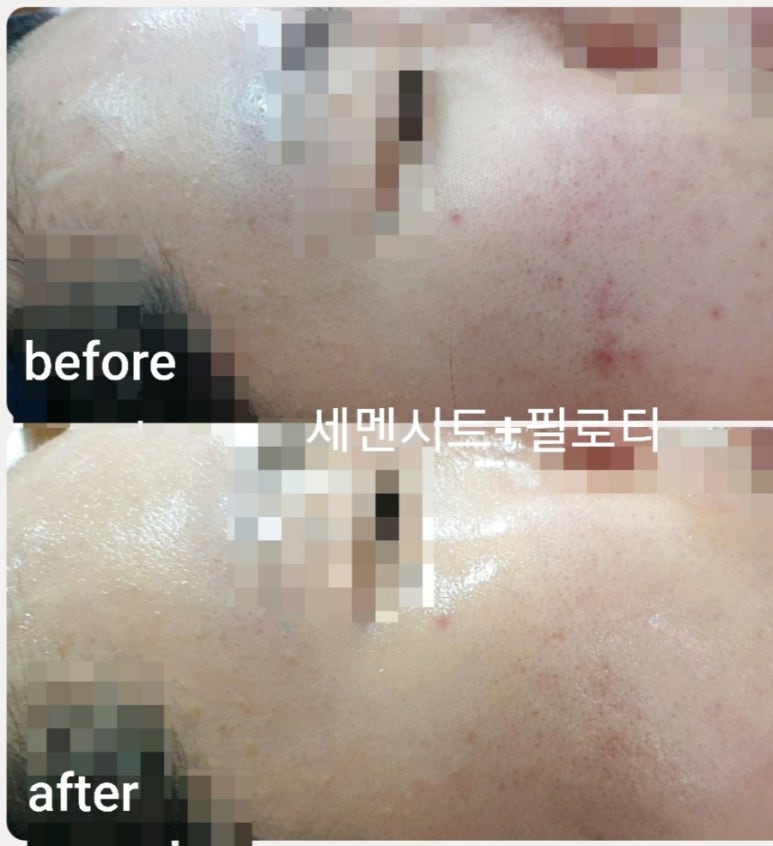 피부빛나다 이미지