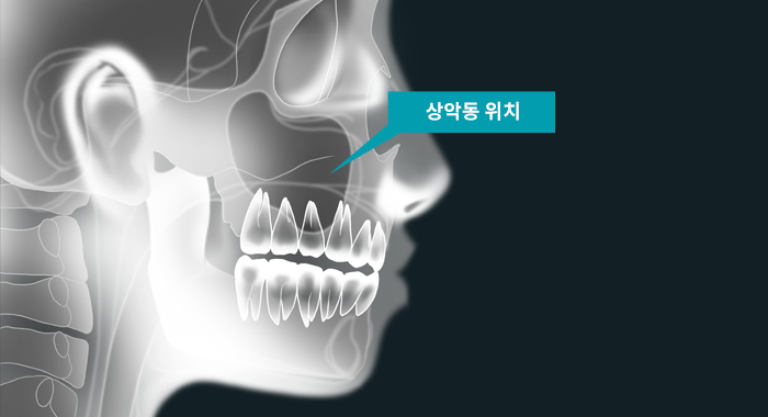 박치과 이미지