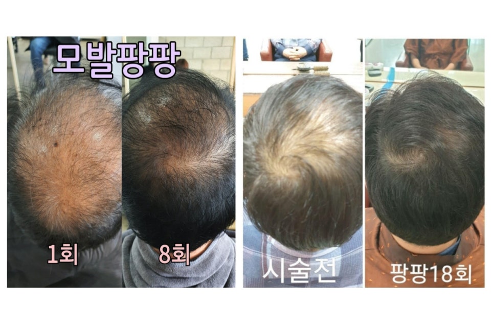 큐사랑머리염색 이미지