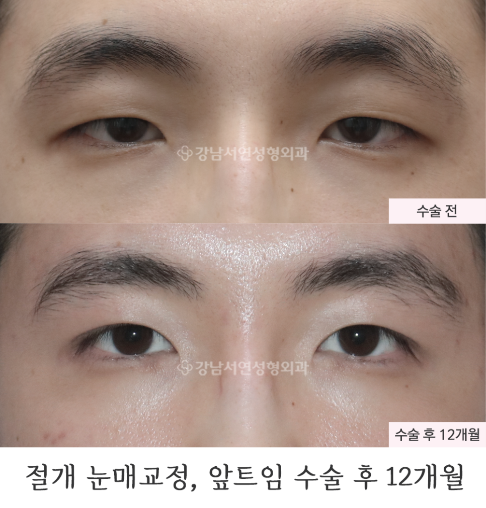서연성형외과의원 이미지
