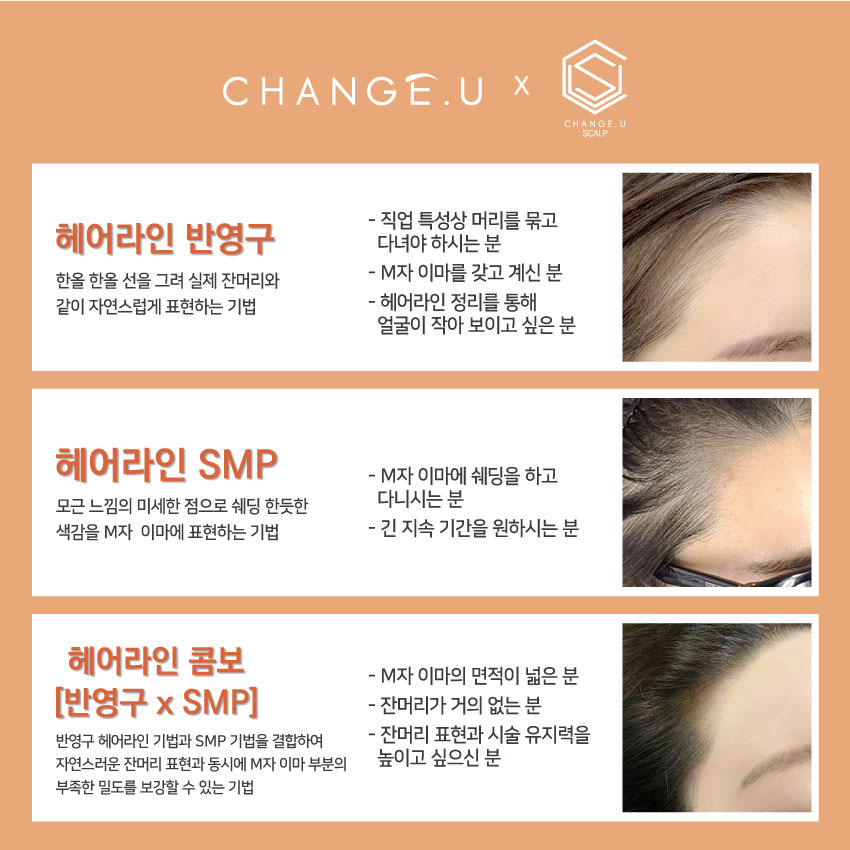 체인지헤어라인 이미지