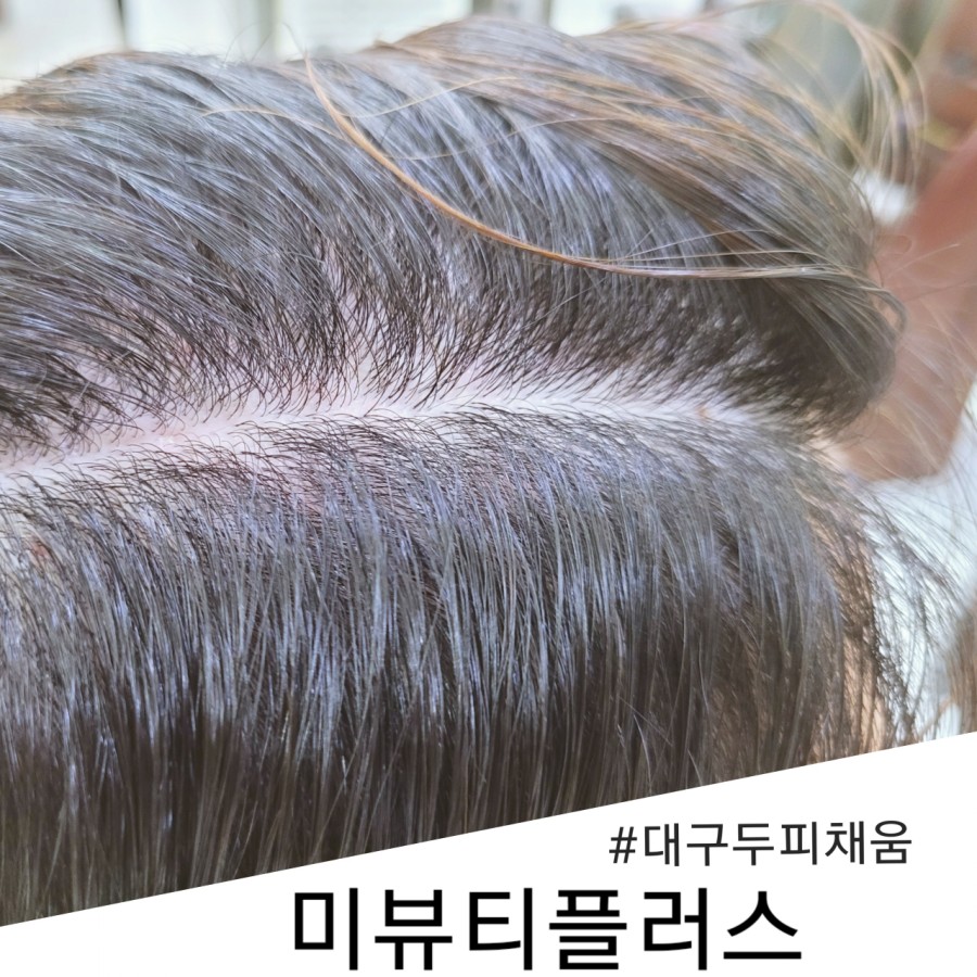 미뷰티플러스 이미지