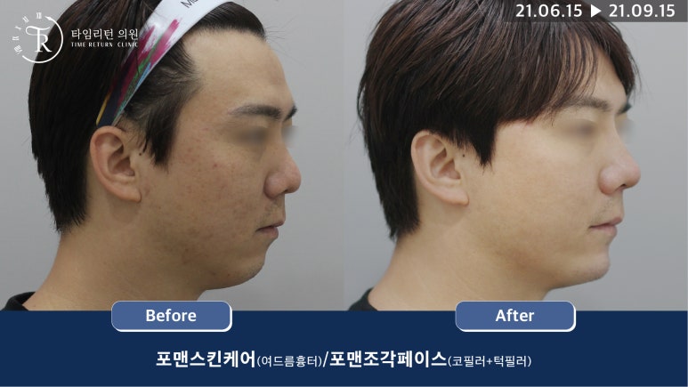 리턴옴므 이미지