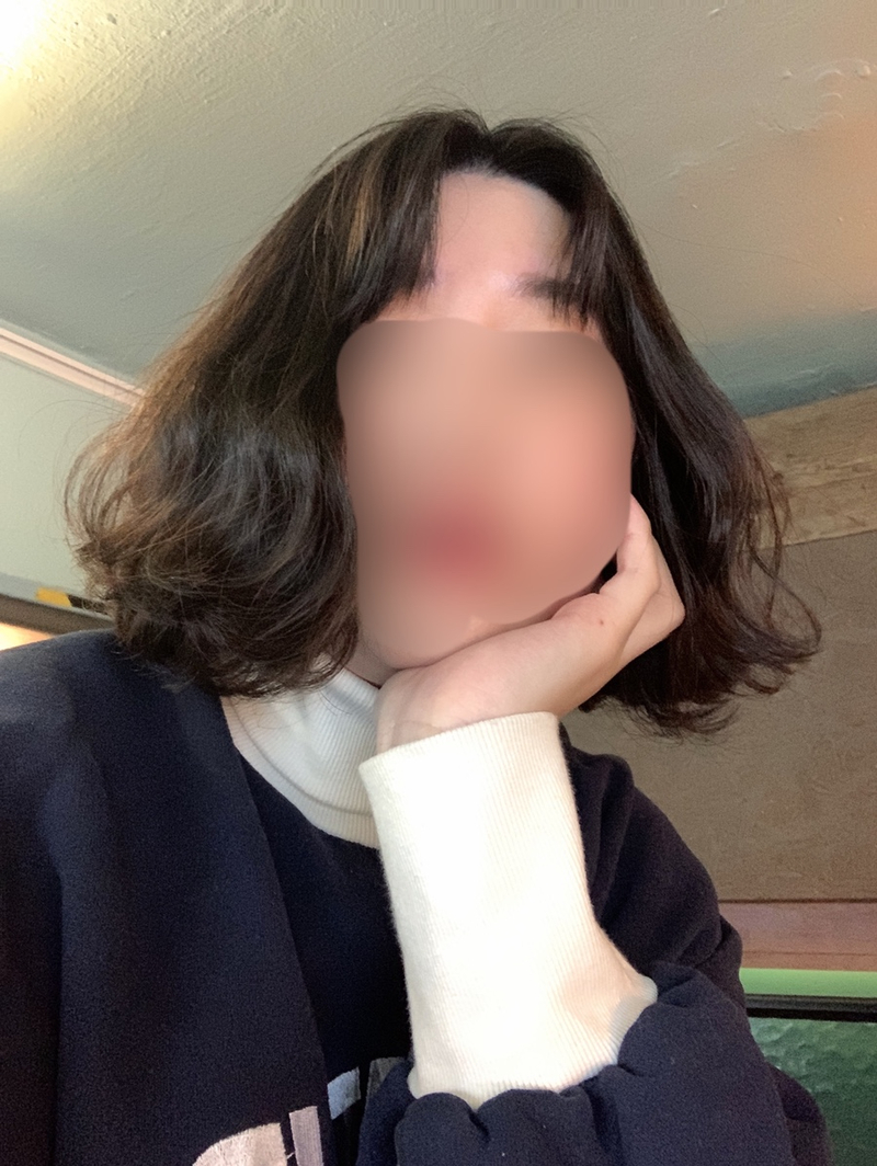 현하윤헤어라인 이미지