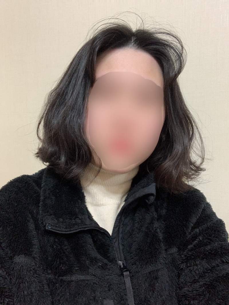 현하윤헤어라인 이미지