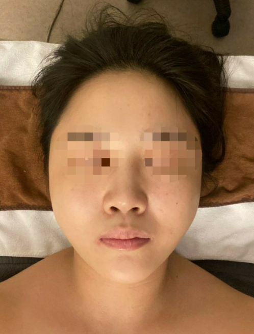 여우스킨 이미지