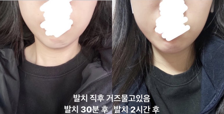 수성사랑니치과의원 이미지