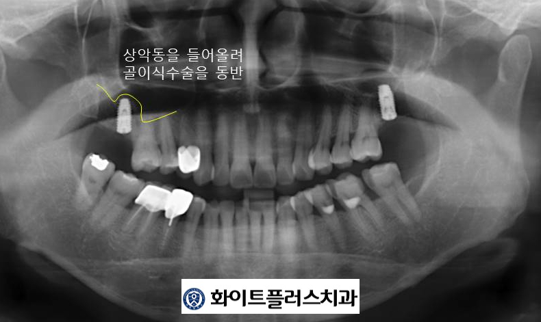 더플러스신길 이미지