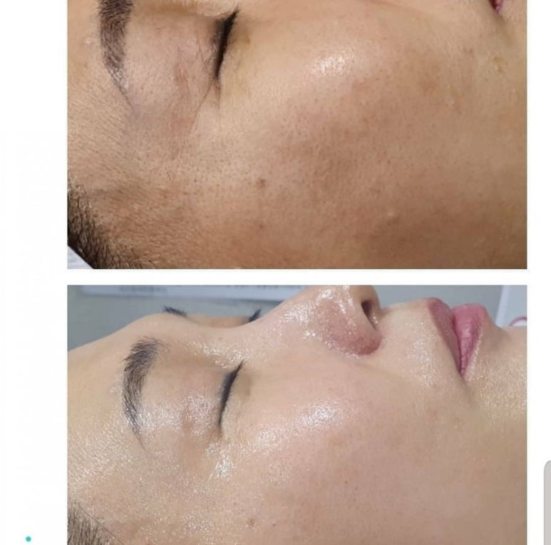 터치피부샵 이미지