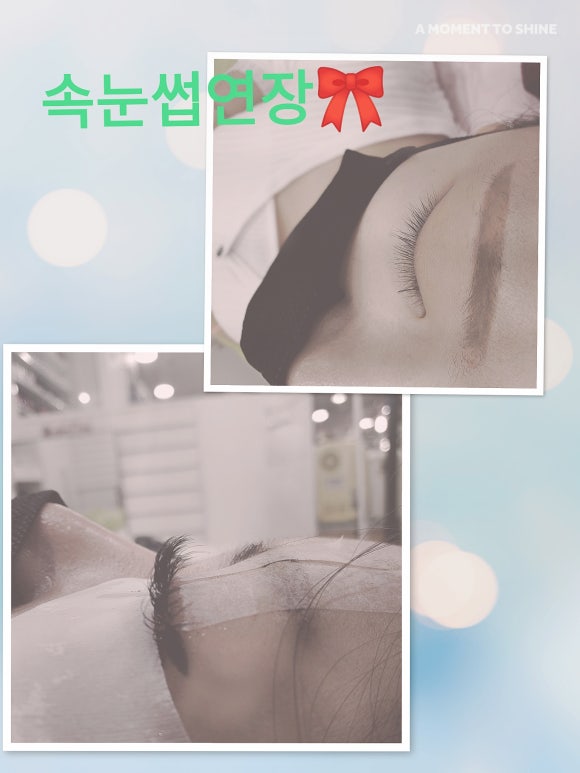 베스코아 이미지