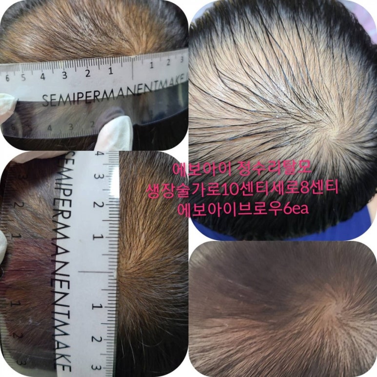 보컨설팅 이미지