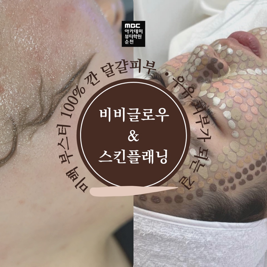비비시스템 이미지