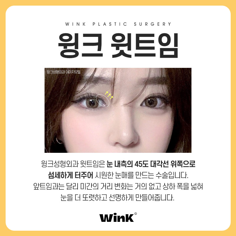 Wink Plastic Surgery Upper Epicanthoplasty for a Line Visible from the Inner Corner image 2