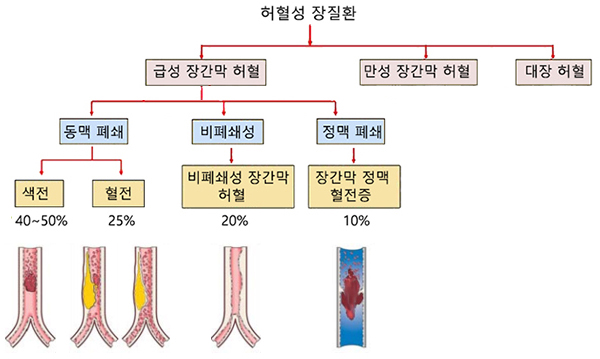 급성 장간막 허혈의 진단 : 네이버 블로그