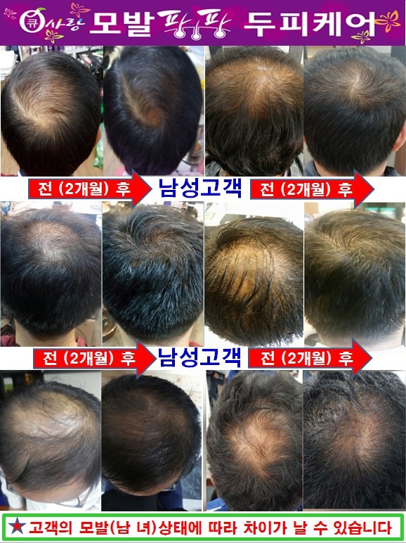 염색팡팡 이미지