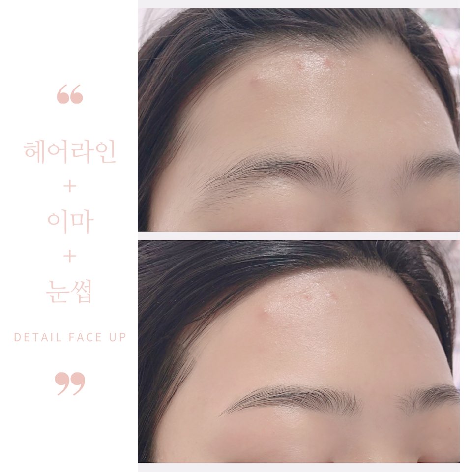 썬헤어라인 이미지