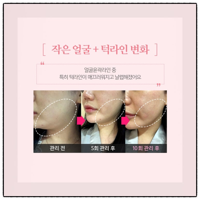 약손피부관리실 이미지