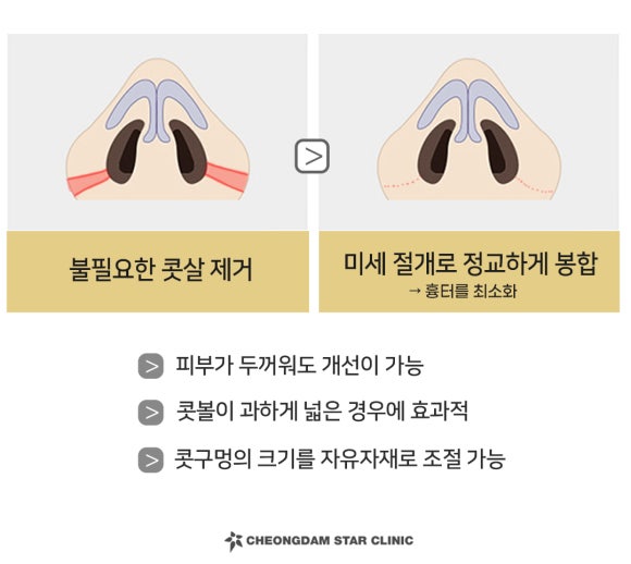 청담세련의원 이미지