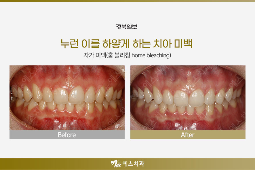 예스이치과의원 이미지