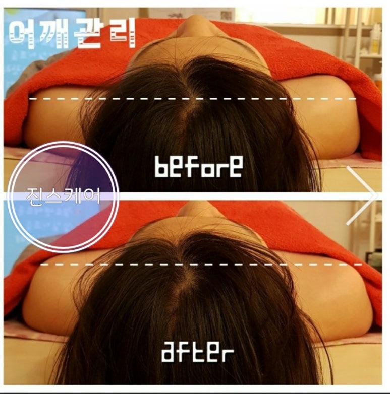 진스케어 이미지