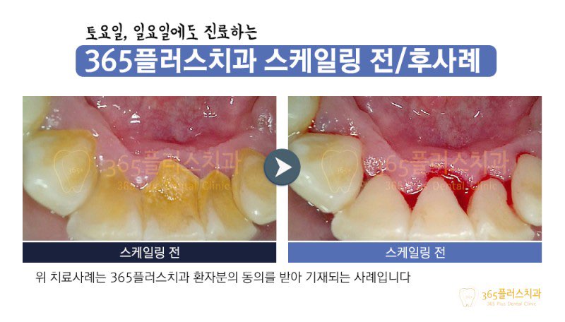 미사플러스치과 이미지