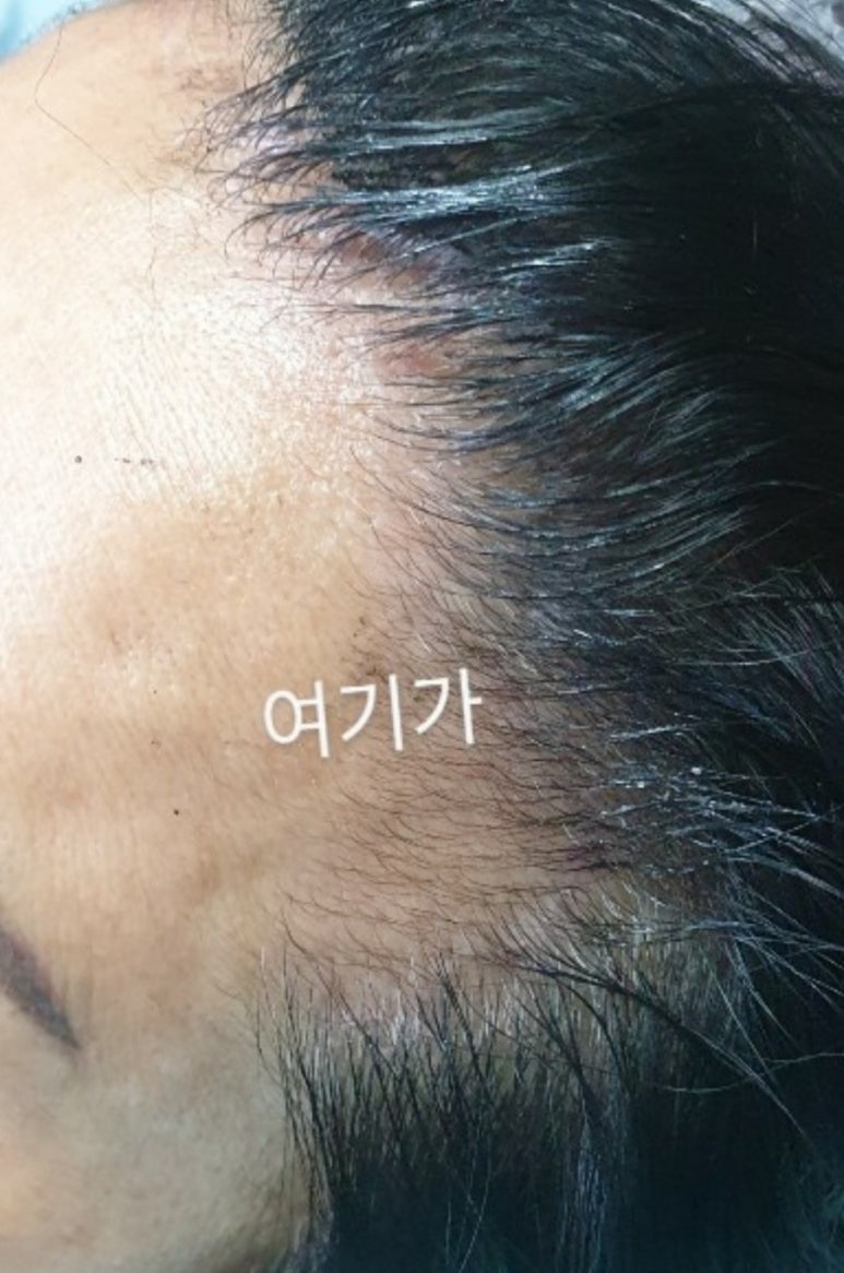 탑헤어스케치 이미지