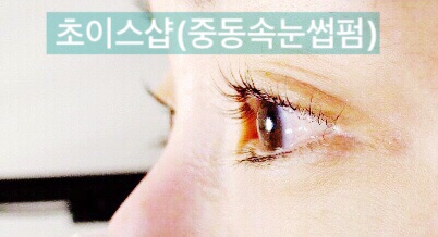 쵸이스샵 이미지